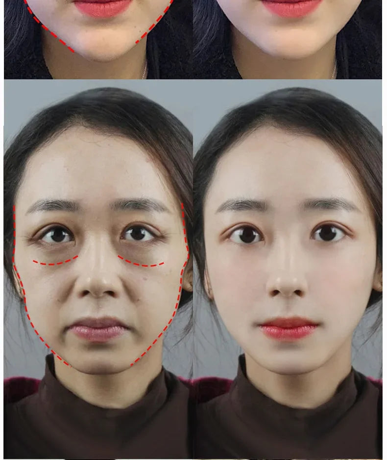 plumping plant essences, hydrating and lightening temples, facial set